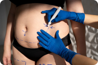 Credit pour chirurgie abdominale